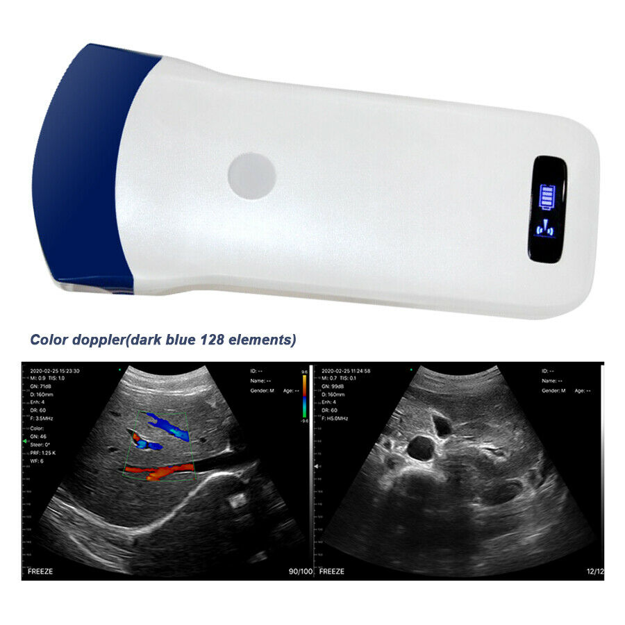 Ultrasound Scanner Color Doppler Probe For Human Usb/wireless Handheld Convex Ce